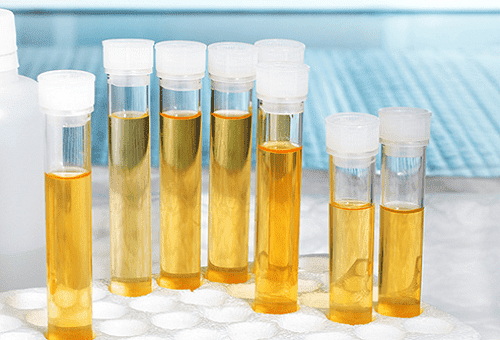 laboratoorsed katseklaasid uriiniga