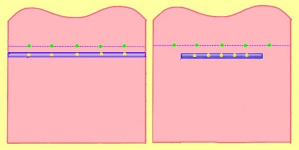 Marcado de elásticos y telas para una distribución uniforme de los pliegues.